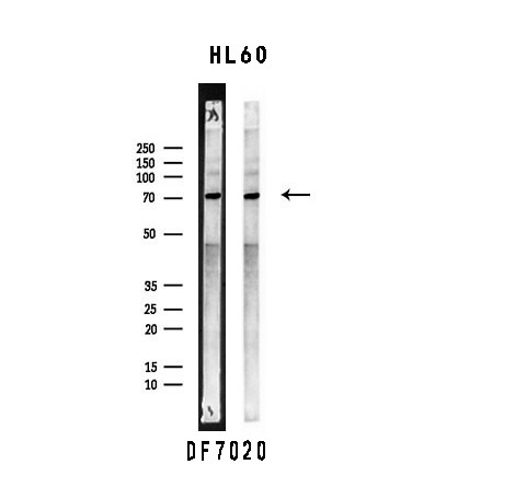 SLP76 Antibody in Western Blot (WB)
