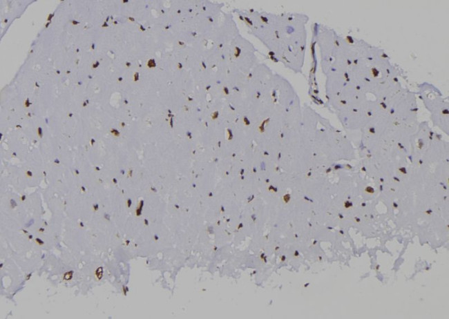 SUMO2 Antibody in Immunohistochemistry (Paraffin) (IHC (P))