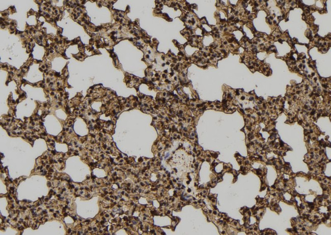 N-WASP Antibody in Immunohistochemistry (Paraffin) (IHC (P))