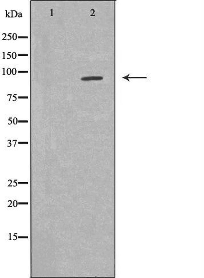 FES Antibody in Western Blot (WB)