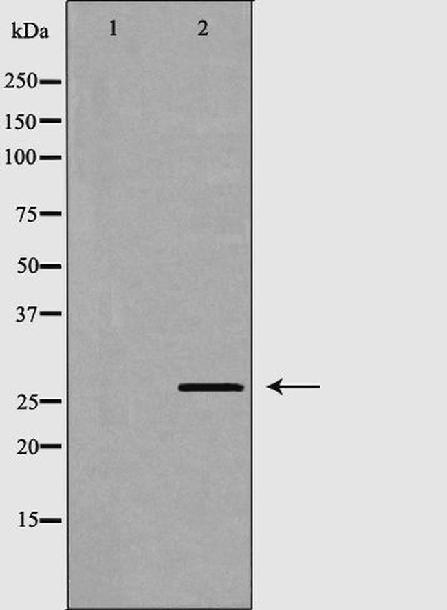 CEACAM3 Antibody in Western Blot (WB)