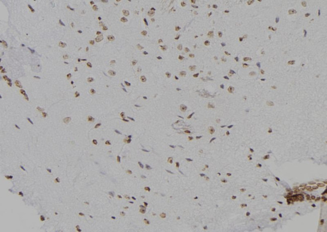 CDK20 Antibody in Immunohistochemistry (Paraffin) (IHC (P))
