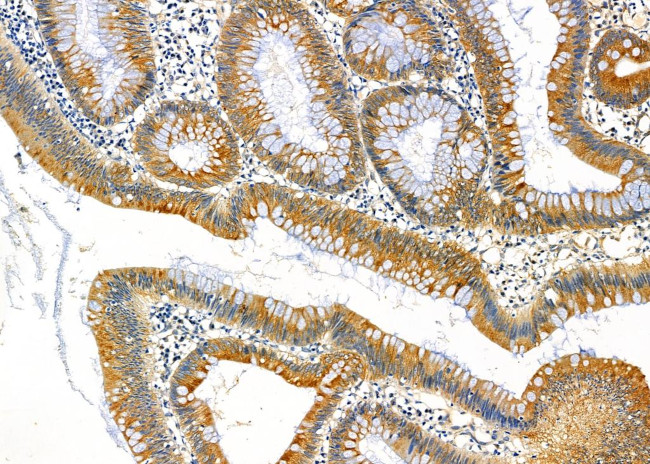 FAM81B Antibody in Immunohistochemistry (Paraffin) (IHC (P))