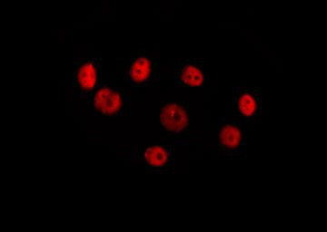 HOXC8 Antibody in Immunocytochemistry (ICC/IF)