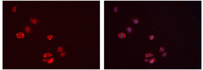 IGFBP7 Antibody in Immunocytochemistry (ICC/IF)