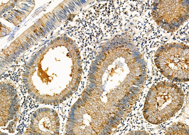 Kallikrein 2 Antibody in Immunohistochemistry (Paraffin) (IHC (P))
