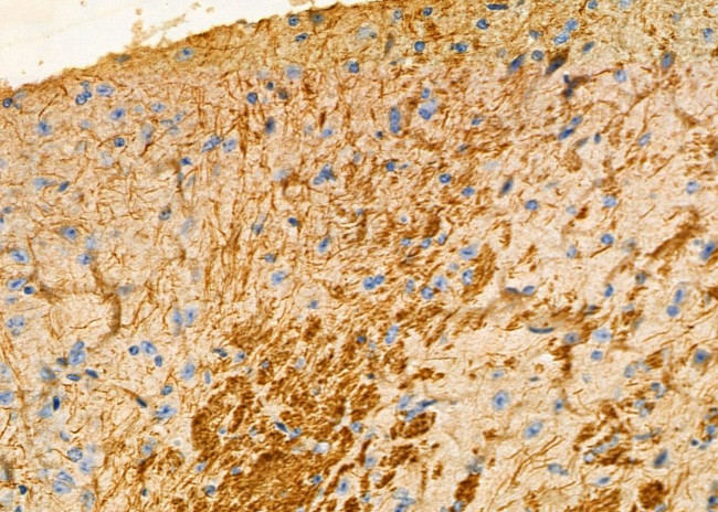 Kallikrein 5 Antibody in Immunohistochemistry (Paraffin) (IHC (P))