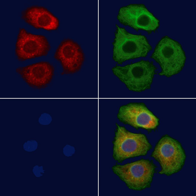 Luteinizing Hormone-beta Antibody in Immunocytochemistry (ICC/IF)
