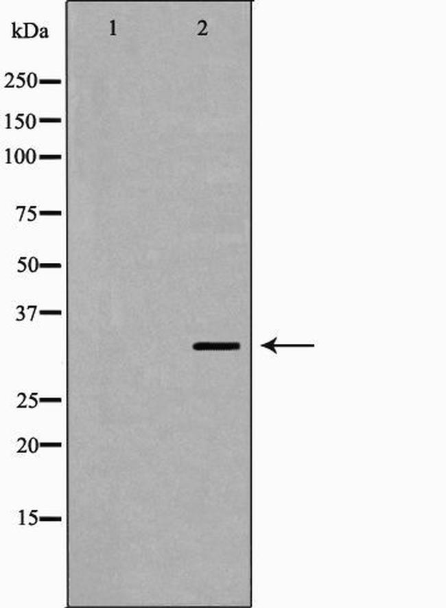 MC2R Antibody in Western Blot (WB)