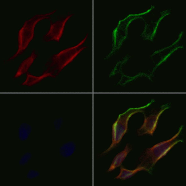 PDK4 Antibody in Immunocytochemistry (ICC/IF)