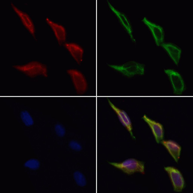 PIBF1 Antibody in Immunocytochemistry (ICC/IF)