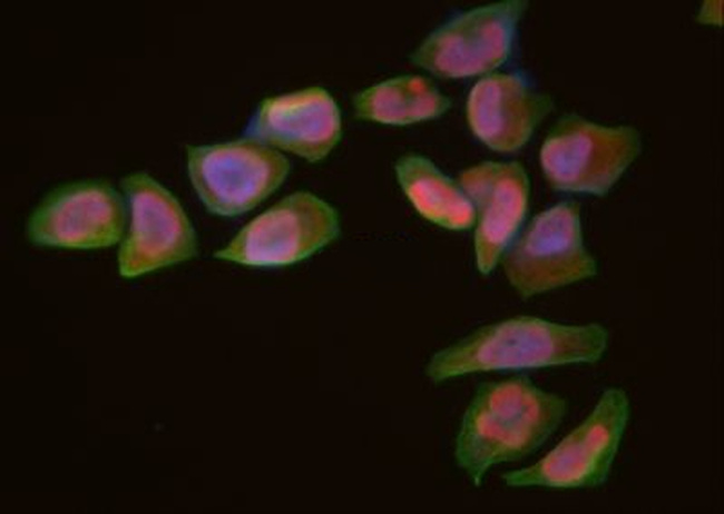 Rad52 Antibody in Immunocytochemistry (ICC/IF)
