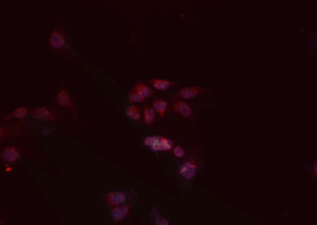 MURF1 Antibody in Immunocytochemistry (ICC/IF)
