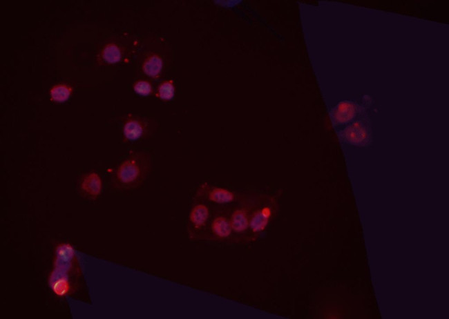 PP2A beta Antibody in Immunocytochemistry (ICC/IF)