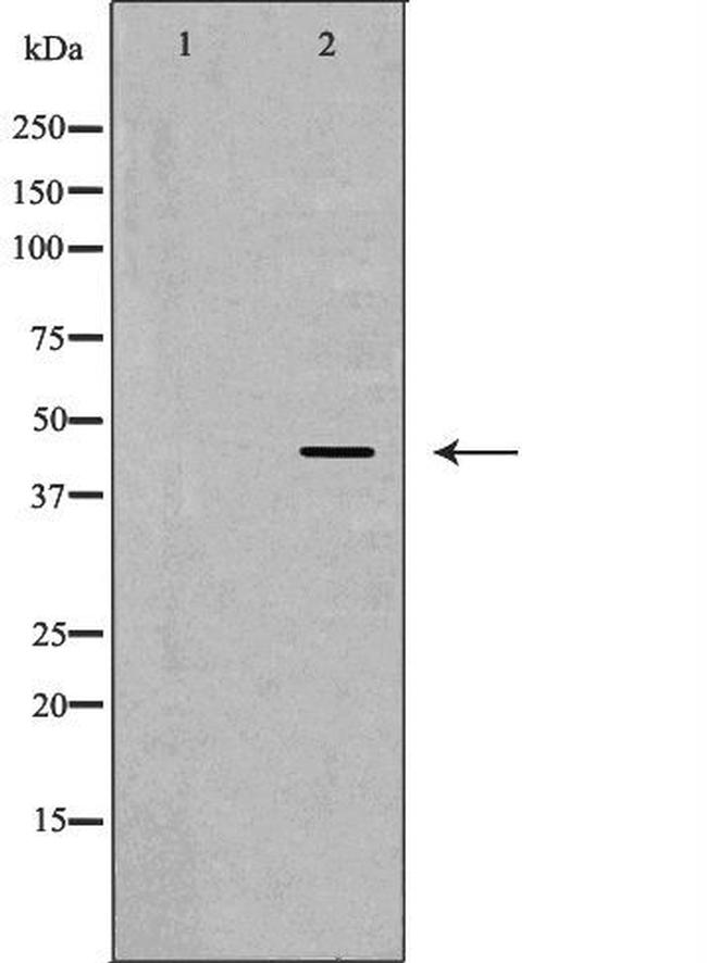 CHI3L1 Antibody in Western Blot (WB)