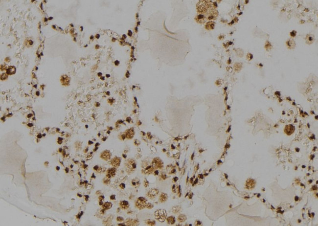 RAD23A Antibody in Immunohistochemistry (Paraffin) (IHC (P))