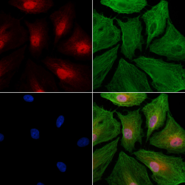 MNAR Antibody in Immunocytochemistry (ICC/IF)