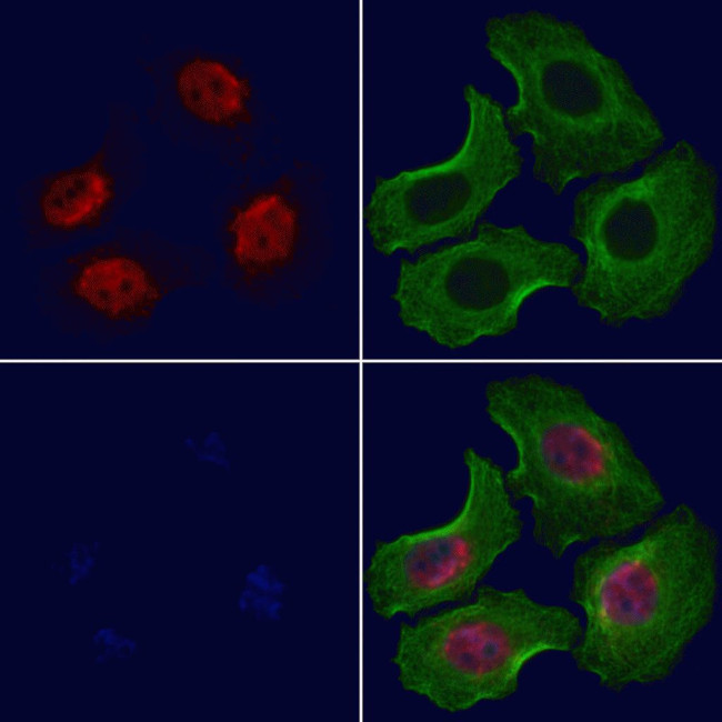 NLK Antibody in Immunocytochemistry (ICC/IF)