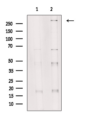 SETD2 Antibody in Western Blot (WB)
