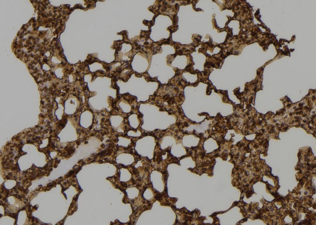SETD8 Antibody in Immunohistochemistry (Paraffin) (IHC (P))
