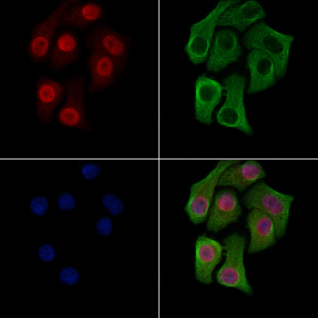H3K14me2 Antibody in Immunocytochemistry (ICC/IF)