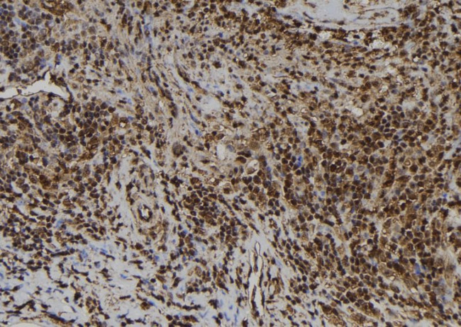 EMAP II Antibody in Immunohistochemistry (Paraffin) (IHC (P))