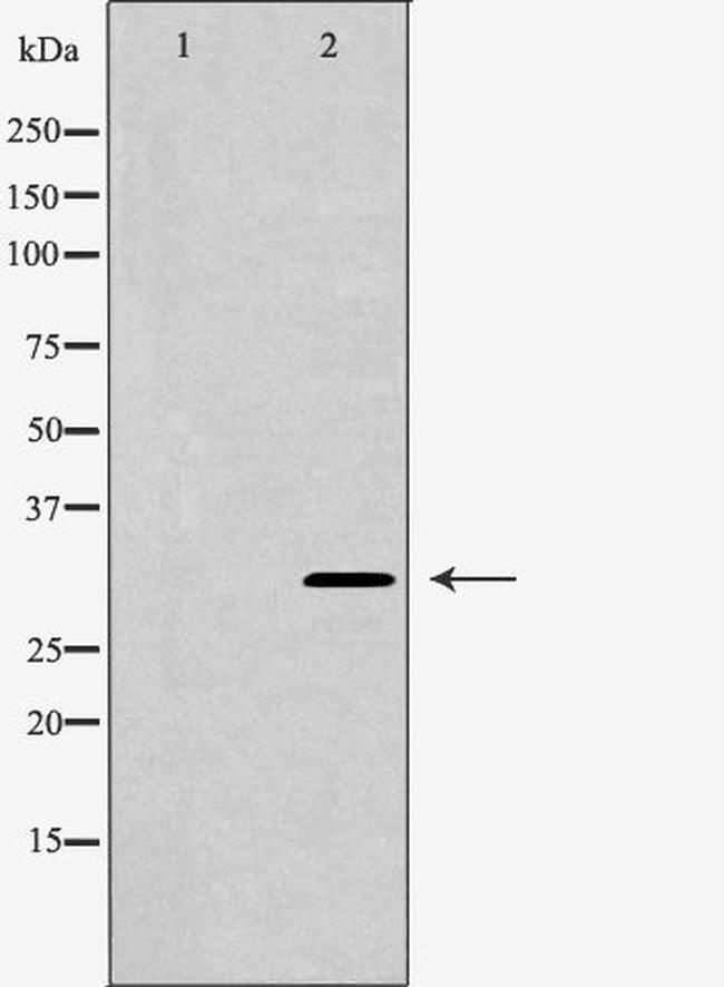CHRNA1 Antibody in Western Blot (WB)