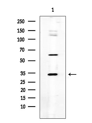 SGCE Antibody in Western Blot (WB)