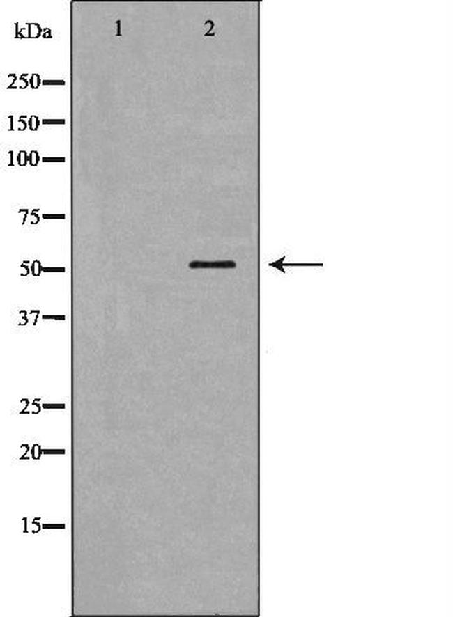 BPI Antibody in Western Blot (WB)