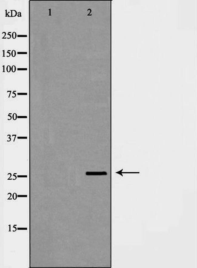 C1QB Antibody in Western Blot (WB)