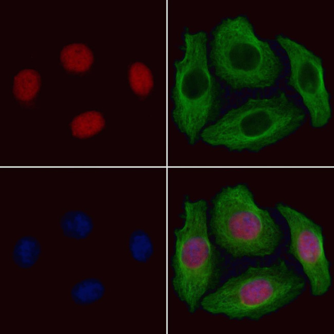 GTF2A1 Antibody in Immunocytochemistry (ICC/IF)