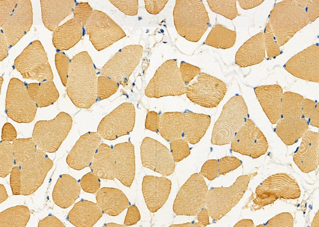 LUM Antibody in Immunohistochemistry (Paraffin) (IHC (P))
