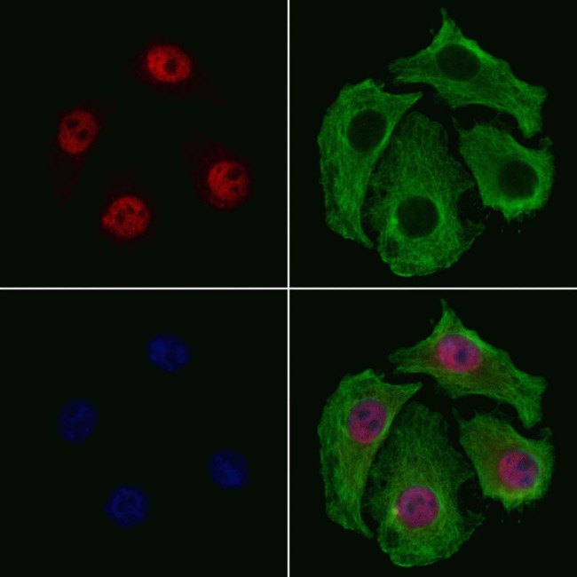 SMARCE1 Antibody in Immunocytochemistry (ICC/IF)