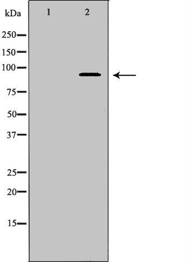 Cullin 5 Antibody in Western Blot (WB)