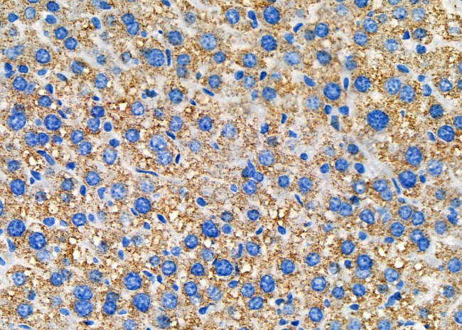 Nectin 2 Antibody in Immunohistochemistry (Paraffin) (IHC (P))