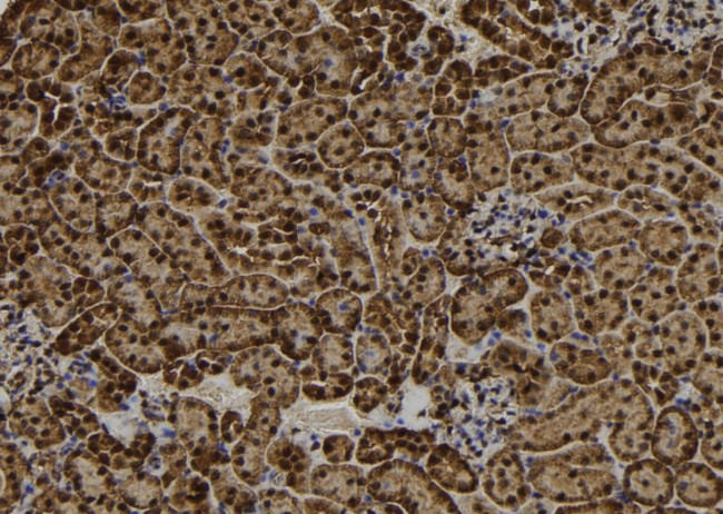RAD18 Antibody in Immunohistochemistry (Paraffin) (IHC (P))