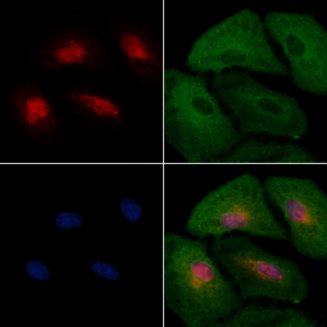 HEC1 Antibody in Immunocytochemistry (ICC/IF)