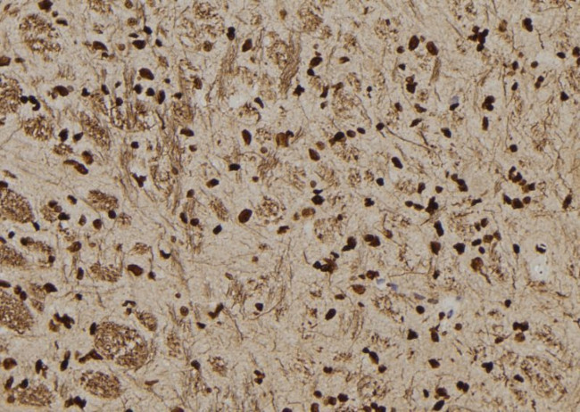 SERPINB3 Antibody in Immunohistochemistry (Paraffin) (IHC (P))