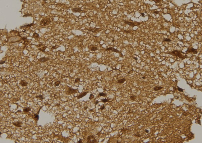 HIF1AN Antibody in Immunohistochemistry (Paraffin) (IHC (P))