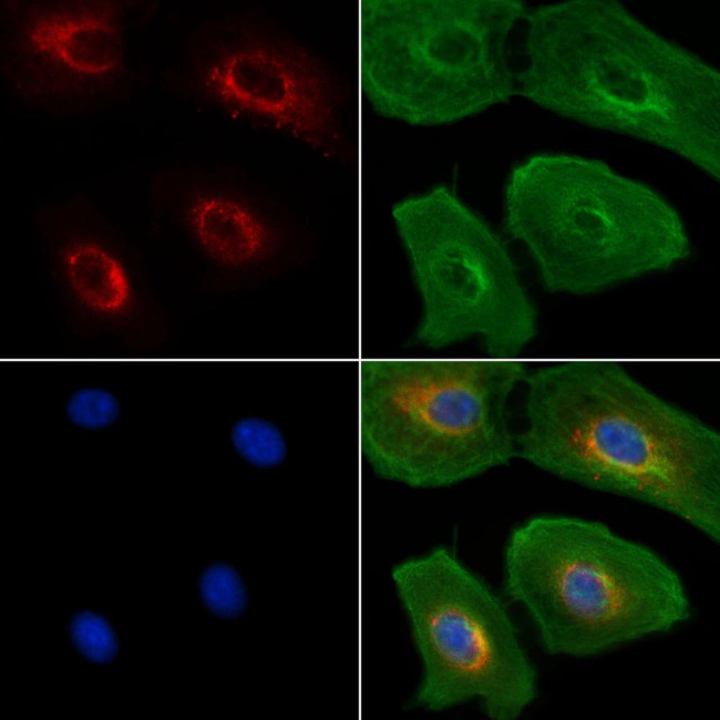 Lamin B Receptor Antibody in Immunocytochemistry (ICC/IF)