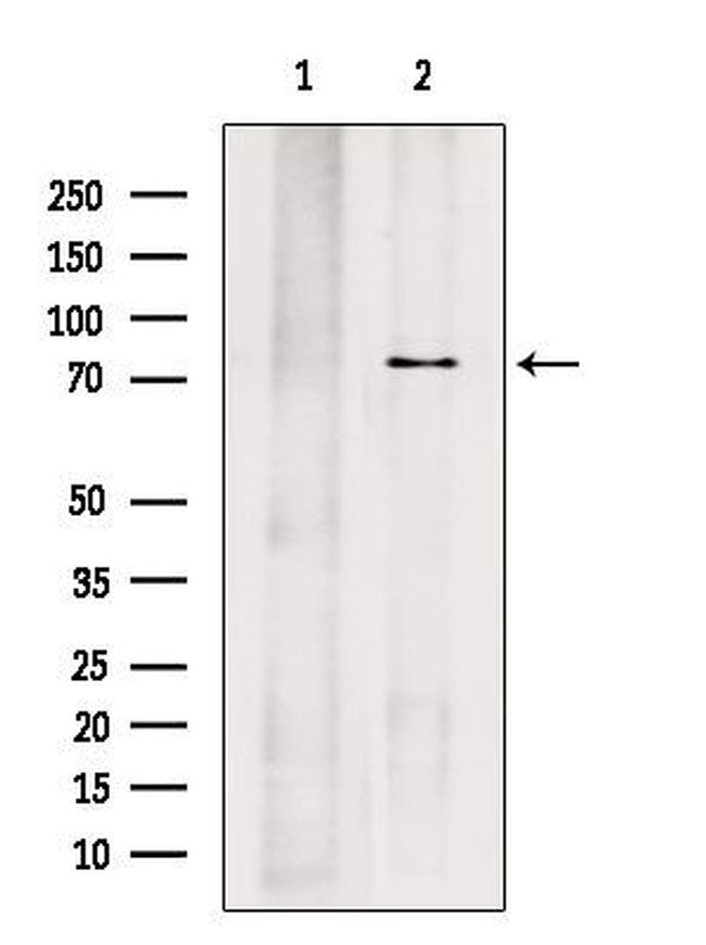 PRPF3 Antibody in Western Blot (WB)