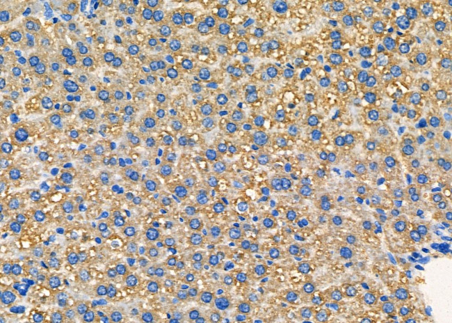 SNRPE Antibody in Immunohistochemistry (Paraffin) (IHC (P))
