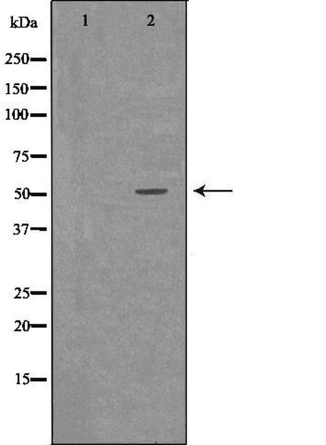Cathepsin A Antibody in Western Blot (WB)