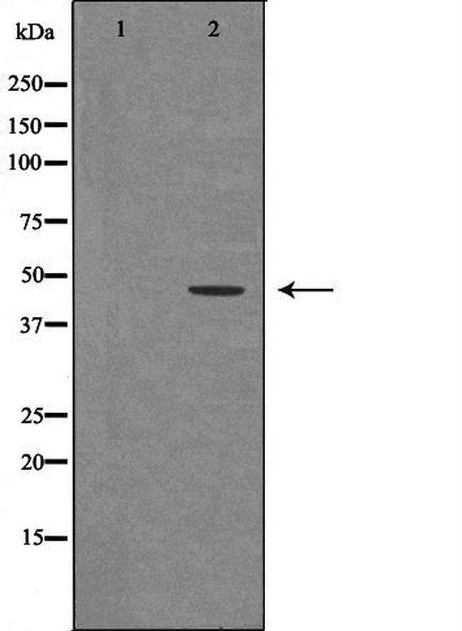 HNRNPF Antibody in Western Blot (WB)