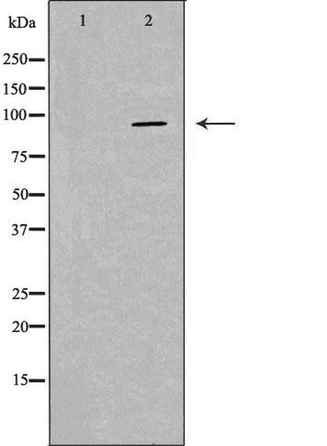 PKP2 Antibody in Western Blot (WB)