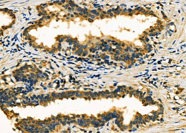 RPLP0 Antibody in Immunohistochemistry (Paraffin) (IHC (P))