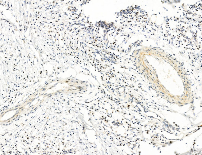 MLKL Antibody in Immunohistochemistry (Paraffin) (IHC (P))