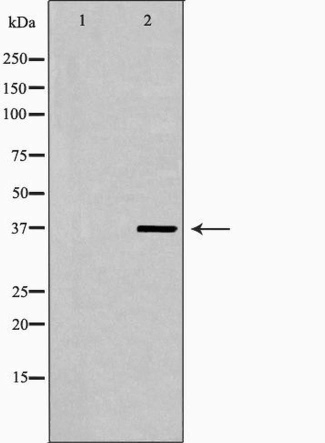 LSP1 Antibody in Western Blot (WB)