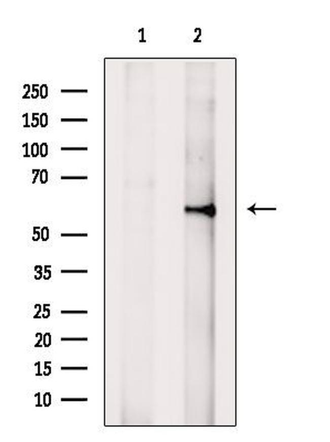 CLN2 Antibody in Western Blot (WB)