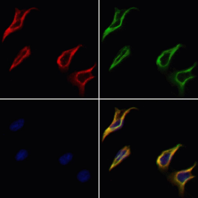 PLTP Antibody in Immunocytochemistry (ICC/IF)